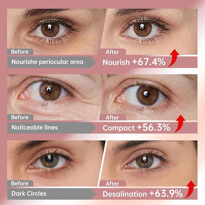 Novoy 15 Pairs Bio-Collagen Real Deep Eye Patches - 6-in-1 Retinol Overnight Eye Patches for Dark Circles, Puffiness & Wrinkles | 2% Caffeine/Hyaluronic/Niacinamide, Korean Popular Eye Mask - Lavender