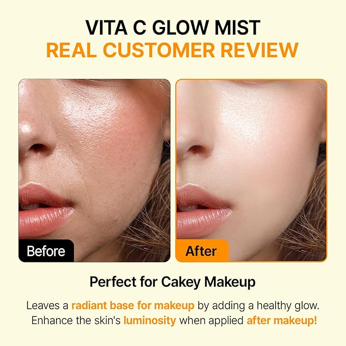Vita C Mist, Glow Mist for Dewy Skin, Makeup Setting Spray for face, Korean Skin Care, Vegan, 3.38 Fl Oz
