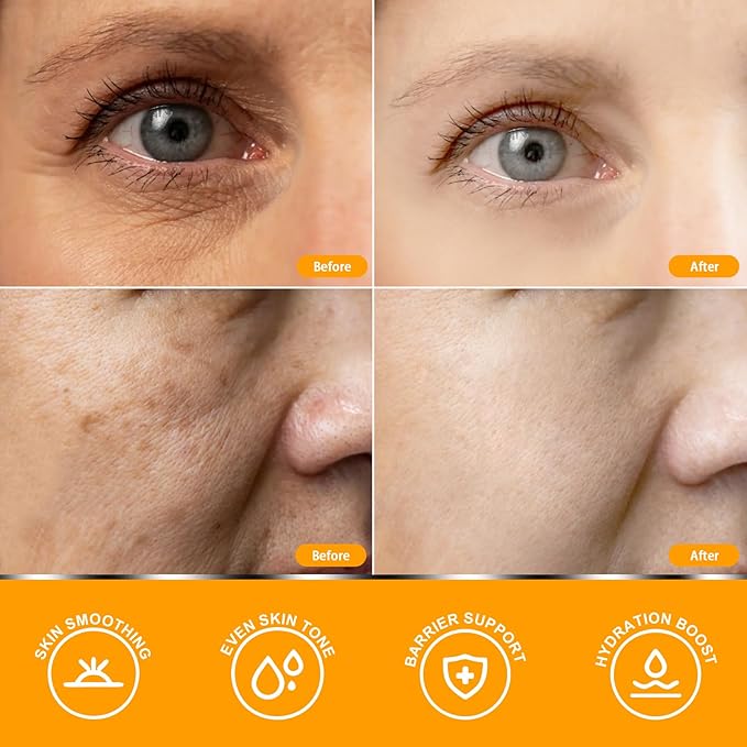 SkinRevive Vitamin C Serum for Women over 70, Vitamin C Serum for Mature Skin Face Hydrates, Firms, Lifts, Targets Age Marks, Wrinkles and Smoothes Skin Texture 1.69 fl oz