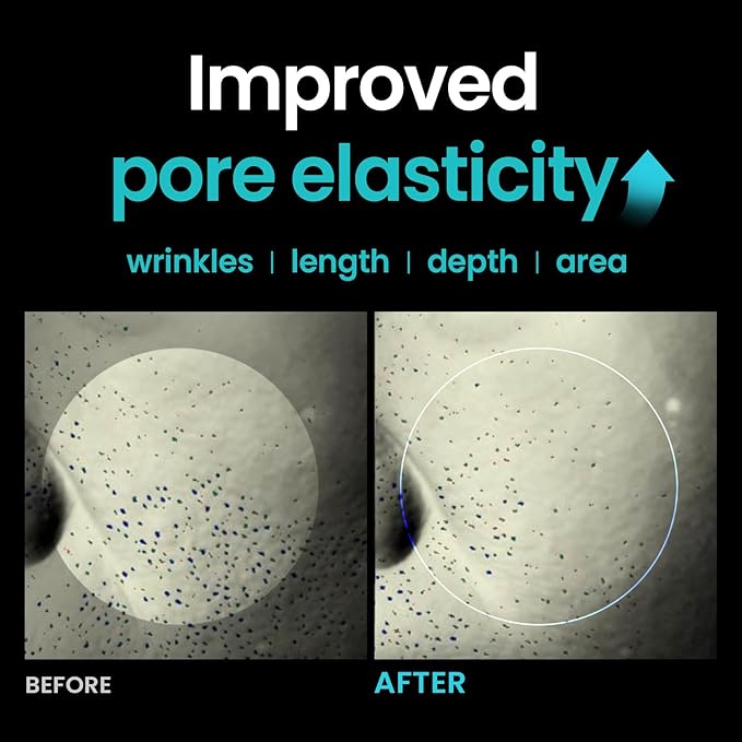 ILSO ER Firming Serum - Retinol 0.1% + Ectoin 1%, Anti-aging & Wrinkle Reducing, Gentle for Sensitive Skin (30ml)