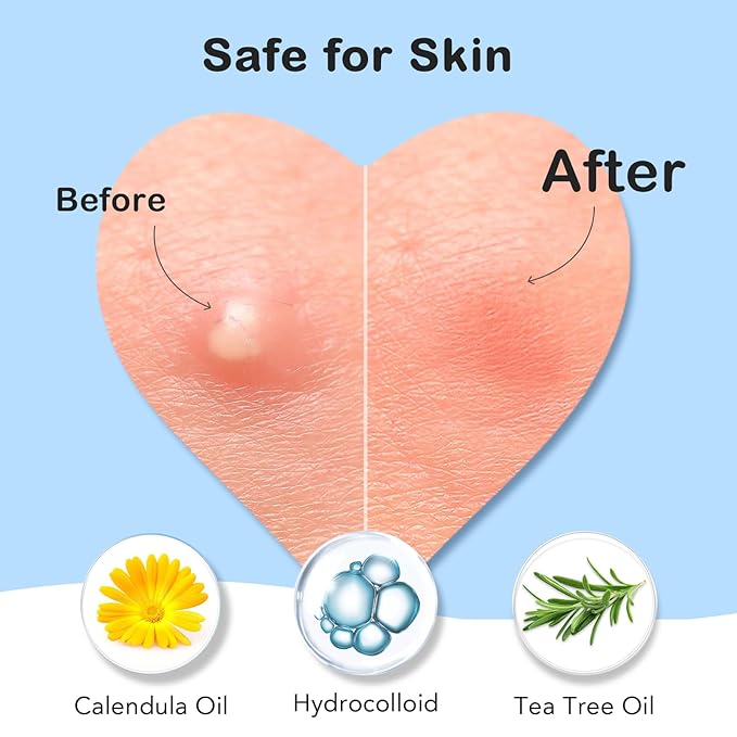 Pimple Patches for Face 7 Sizes Day and Night Acne Patches Heart Zit Patches Cute Spot Stickers with Tea Tree & Centella Oil, Strong Adhesion Zit Covers (412 Count)