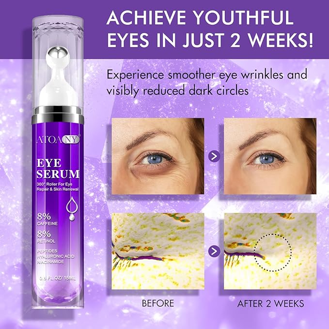2 Packs Eye Serum for Dark Circles and Puffiness with 8% Caffeine 8% Retinol Hyaluronic Acid Niacinamide, Under Eye Cream Anti Aging for Puffiness and Bags with 360° Eye Roller Ball for Women & Men