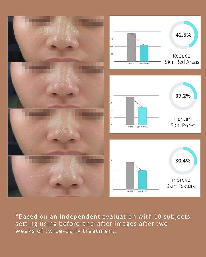 Hydrogen Rich Water Facial Sprayer Nano Mister Portable Face Deep Moisturizing | SPE PEM Technology for Face Hydrating Antioxidant Skin Care Daily Makeup 1400 ppb- Upgraded