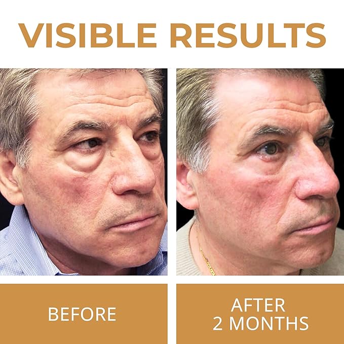 ABERA Natural Repair Eye Cream with Set 15 Eye Masks, Minimizes Under Eye Bags & Dark Circles, Reduce Puffiness, Wrinkles and Fine Lines, 0.5 fl oz