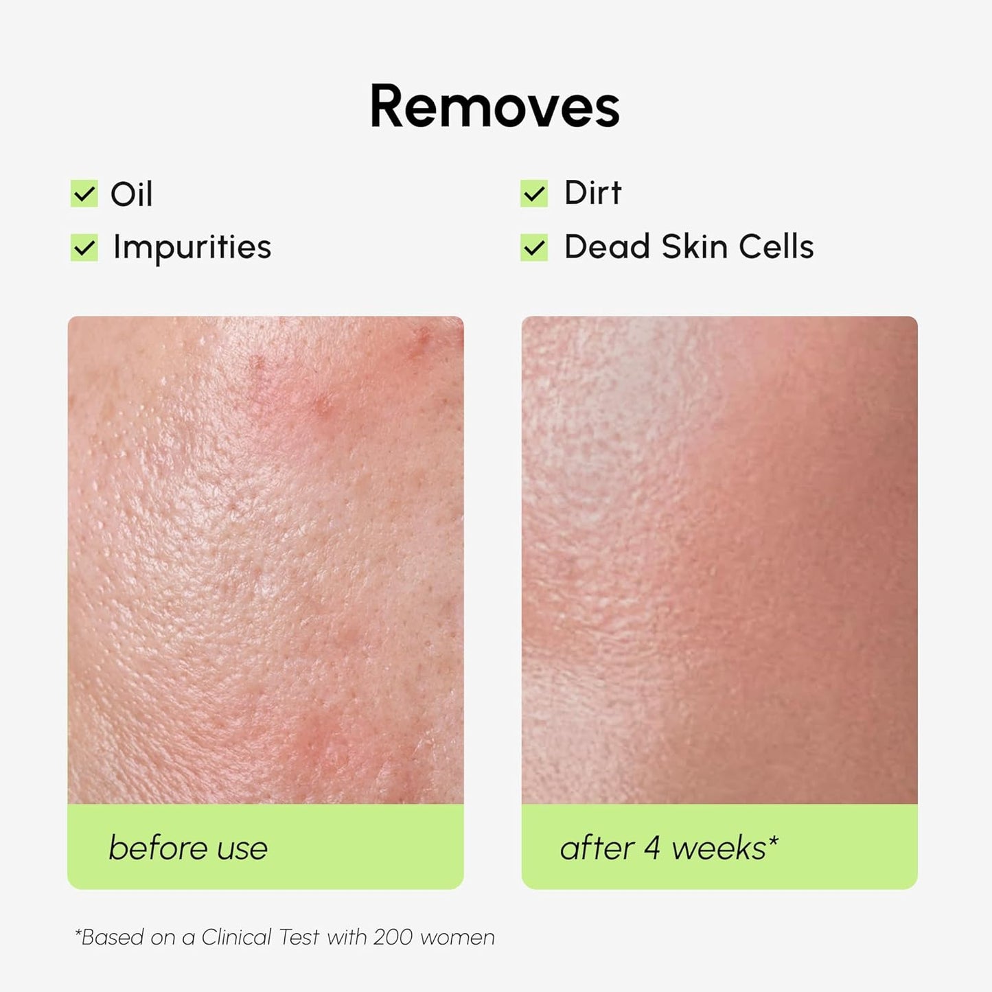 MAREE Exfoliating Toner with Salicylic Acid – AHA BHA Face Exfoliant & Pore Cleaner – BHA Liquid Exfoliant for Sebum & Dead Skin Care Remover – Face Exfoliator – Acido Salicilico Exfoliante Facial