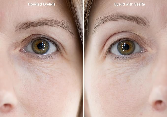 SeeRa: Instant Lifting Eyelid Tape for Hooded & Droopy Eyes - Hypoallergenic, Waterproof, Invisible Eye Lift Strips, Non-Surgical, Eyelid Lifters & Stickers-90pcs (4mm-7mm) (6mm-Moderate)