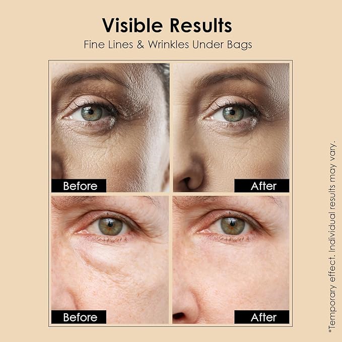 Instant Temporary Eye Tightener: Eye Tightener cream Reduces Under Eye Bags, Dark Circles & Puffiness, Anti Aging Fine Lines, Firm That Delicate Skin Under Your Eyes 0.9 OZ
