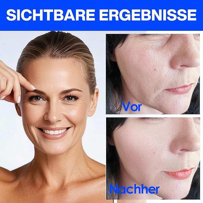 Face Tape for Wrinkles Overnight, Face Patches,Face Easticity Lift, Long Term Prevention of Forehead,Vertical, Crow's feet, nose and Neck Wrinkles