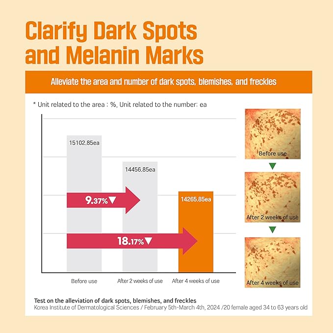 ROUND LAB Vita Niacinamide Dark Spot Serum 1.01 Fl Oz, Radiance-Boosting and Dark Spot Correcting Face Serum with Vitamin C, Improves Uneven Skin Tone, and Enhances Skin Clarity, Korean Skincare