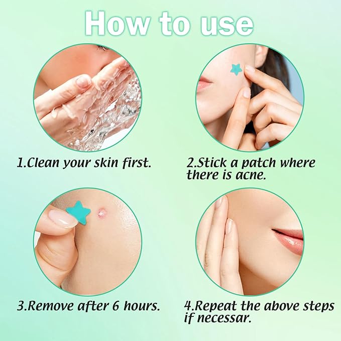 Pimple Patches For Face 240 Counts Hydrocolloid Acne Patches Colorful Zit Patches Acne Dots Blemish Patches with Salicylic Acid Tea Tree Oil Calendula Oil 3 Sizes Acne Patches Star Pimple Patches