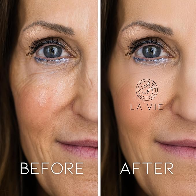 La Vie Anti-Aging Night Cream – Night Cream for Women Anti-Aging with Niacinamides, Hyaluronic Acid - Retinol Moisturizer Against Wrinkles – 1.7Fl Oz