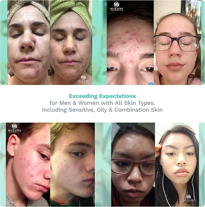 Purifying Toner for Face & Skin – Pore Minimizer Facial Astringent Acne Treatment for Women & Men – Witch Hazel, Lavender, Sage & Hops Combination for All Skin Including Dry, Oily and Sensitive