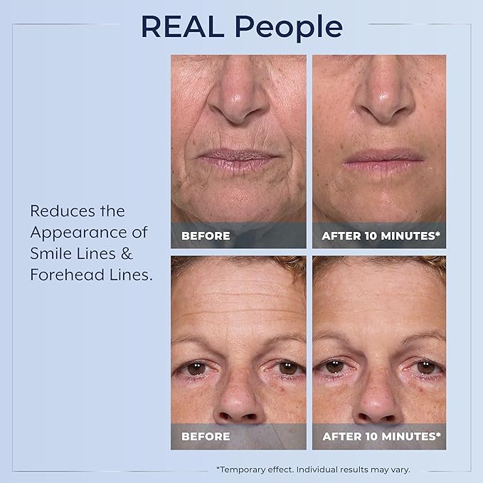 Plexaderm Rapid Reduction Eye Serum - Visibly Reduces Under-Eye Bags, Wrinkles, Dark Circles, Fine Lines & Crow's Feet Instantly, Anti Aging Wrinkle Remover for Face, Pump