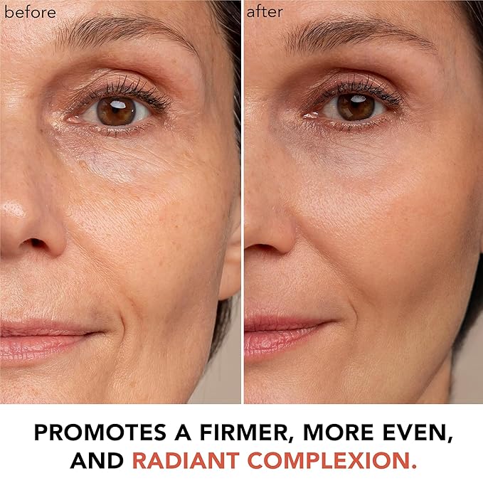 Beauty by Earth Vitamin C Face Cream - USA Made with Organic & Natural Ingredients, Skin Brightening Cream for Face, Discoloration Correcting & Anti Aging Moisturizer for Face with Antioxidants