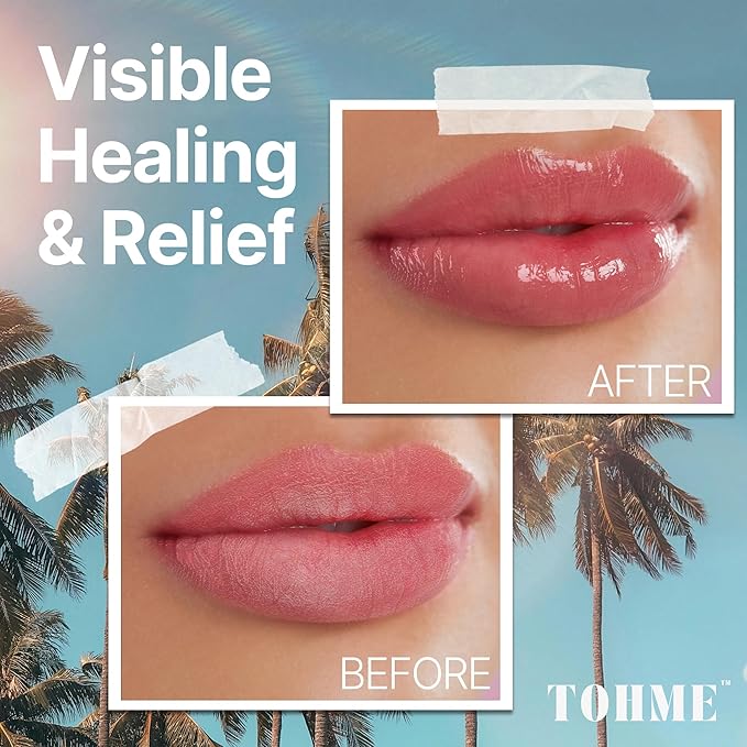 Nourishing & Hydrating Lip Balm - Naturally Soothing Lip Moisturizer for Eczema & Dry Cracked Lips - Moisturizing Lip Care with Mongongo Oil & Manuka Honey (.25 oz)