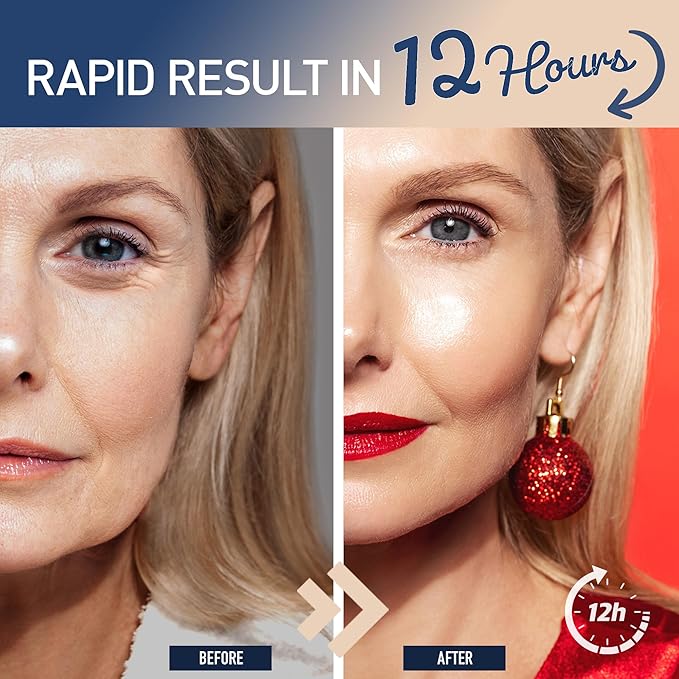 Enaskin Naturals Instant Eye & Face Lift Cream: Rapid Under Eye Bags Wrinkles Puffiness Remover for Women and Men in 60s - Temporary Firming & Tightening Treatment - Wrinkle Filler - 0.5 oz