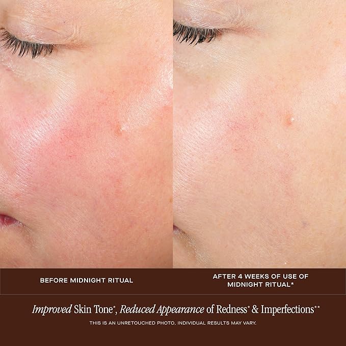 Summer Fridays Midnight Ritual Retinol Serum - Renewal Anti Aging Serum for Face, Fine Lines & Discoloration - Enriched with Jojoba Oil, Hyaluronic Acid & Niacinamide to Renew Skin's Appearance (1 oz)