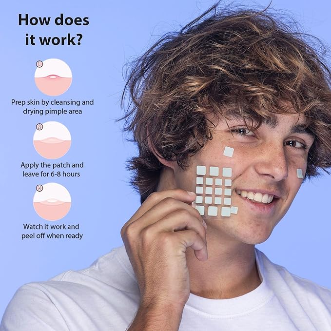 Frilliance Green Square Soothing Aloe & Hydrocolloid Acne Pimple Patches for Zits and Blemishes (18 Count, 2 Sizes) Spot Treatment Stickers for Face & Skin, Vegan and Cruelty Free