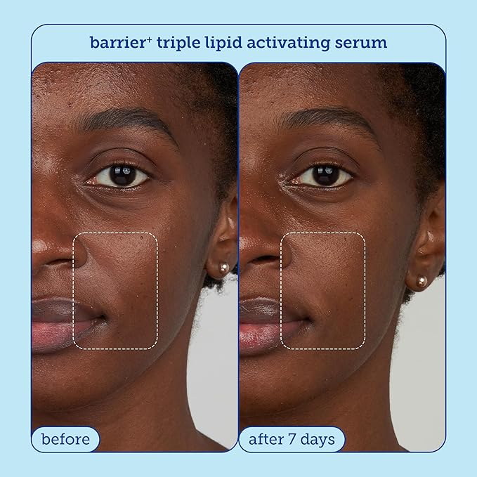 Skinfix Barrier + Firm Trio - Full-Size Plumping Serum, Mini Moisturizer, Mini Eye Cream with Patented B-L3™ Complex - Hydrate & Strengthen Skin Barrier