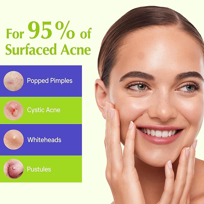 Pimple Patches For Face, Invisible Hydrocolloid Acne Patches Acne Treatment,Covering Zits & Blemishes in Skin and Face, Zit Patches with Salicylic Acid, FSA HSA Store Eligible Items 36 Count