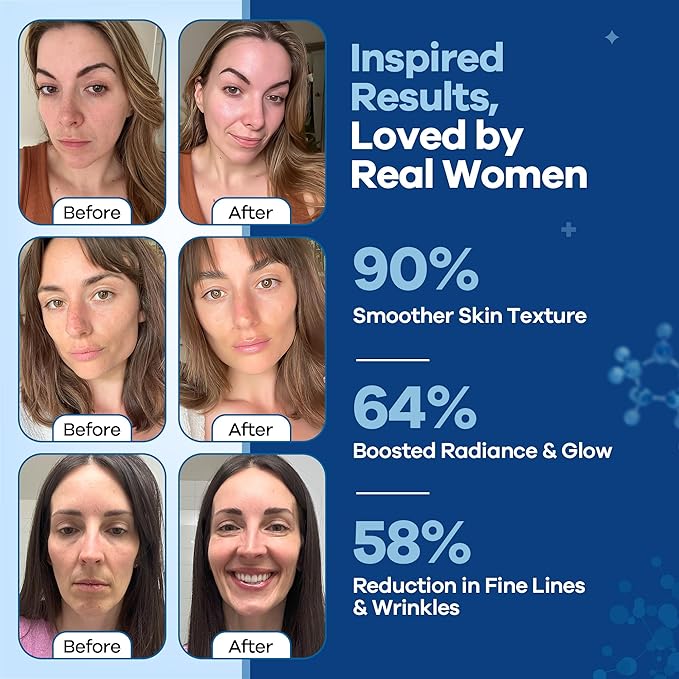 Original Turmskin Hyaluronic Acid Serum | Ultimate Hydration Boost for Your Aging Skin | 3% for 24-Hour Hydration & Glass Skin, Soft PE Ampoule Vials for Face & Skin