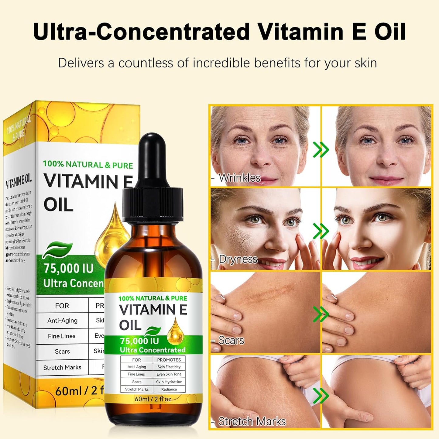2 Pack Pure Vitamin E Oil, 75,000 IU Ultra Concentrated & Natural for Stretch Mark/Scars Treatment, Smoothing & Moisturizing Skin & Hair & Cuticles, Cold Pressed/Hexane Free/Non-GMO, 60ML/2Fl Oz