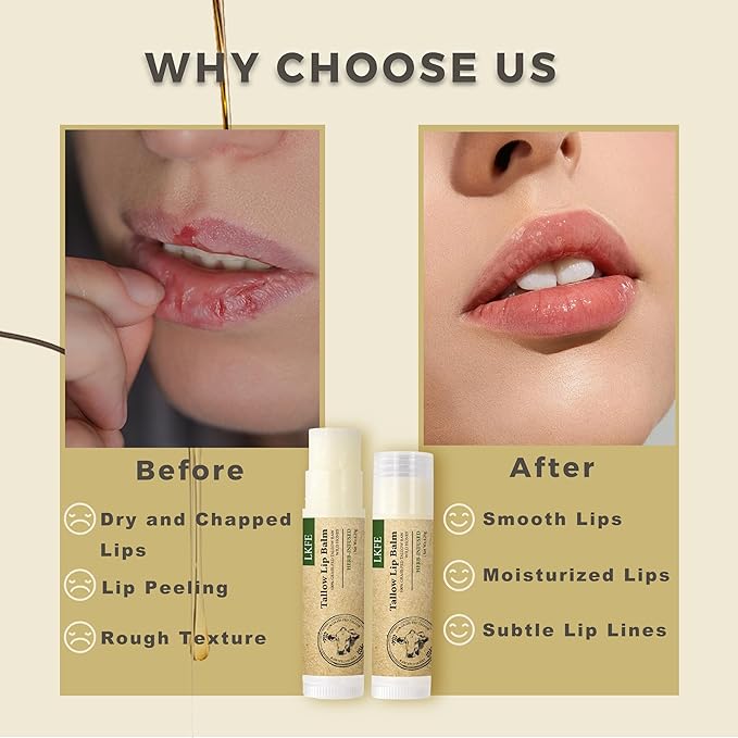 Beef Tallow Lip Balm, Herb-infused Natural Lip Moisturizer, Grass Fed Beef Tallow & Beeswax – Hydrating Chapstick for Dry, Chapped Lips, Vitamin-Rich & Long-Lasting Lip Care
