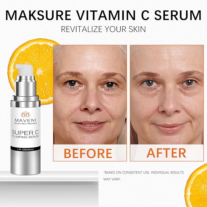 Super C Serum for Mature Skin, All-in-One Vitamin Formula Hydrates, Dark Spot Serum, Hydrates, Firms, Lifts, Smooths, Wrinkles, Reduce Dark Spots, Targets Age Spots & Wrinkles, 1 fl oz