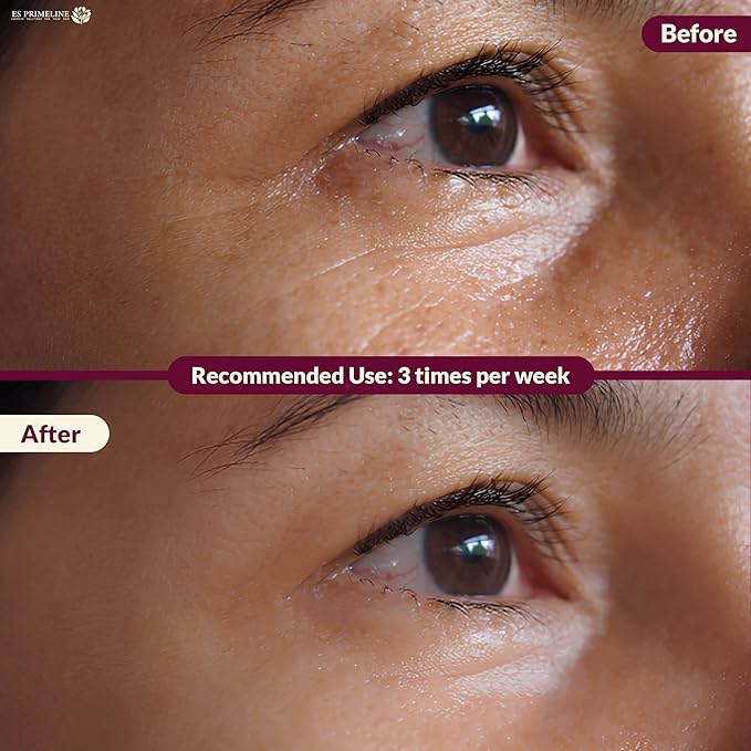 Under Eye Patches Booster Pomegranate &10ml Serum –12 Pairs for Puffy Eyes Dark Circles Eye Bags Anti-Wrinkle Collagen Retinol Anti Aging Hydrating Birthday Gift