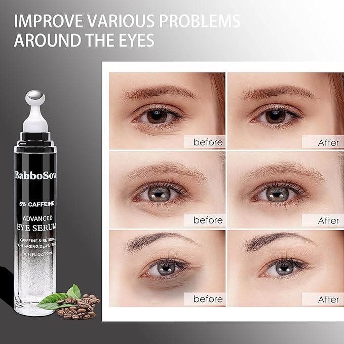 Caffeine Eye Cream - Eye Serum with 5% Caffeine & 5% Retinol Anti-Aging Formula with Hyaluronic Acid Niacinamide & Peptides for Dark Circles, Puffiness & Fine Lines – 360° Massage Roller Ball