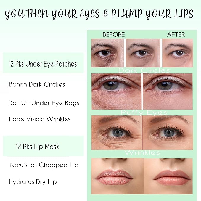 CCbeauty 24 Packs Lip Masks & Eye Mask Bulk,24K Gold Under Eye Patches for Puffy Eyes,Dark Circles,Collagen Eye gel Pads for Eye Bags,Wrinkles | Nourish & Hydrate Dry Chapped Lips Skincare,Golden