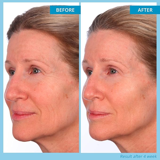 SKINN Deep Wrinkle Facial Serum, Intensive Age Reset Serum - Anti Wrinkle Repair Face Serum - Hydrating & Plumping Anti Aging Serum Reduces Fine Lines - Ferulic Acid, Retinol & Vitamin C