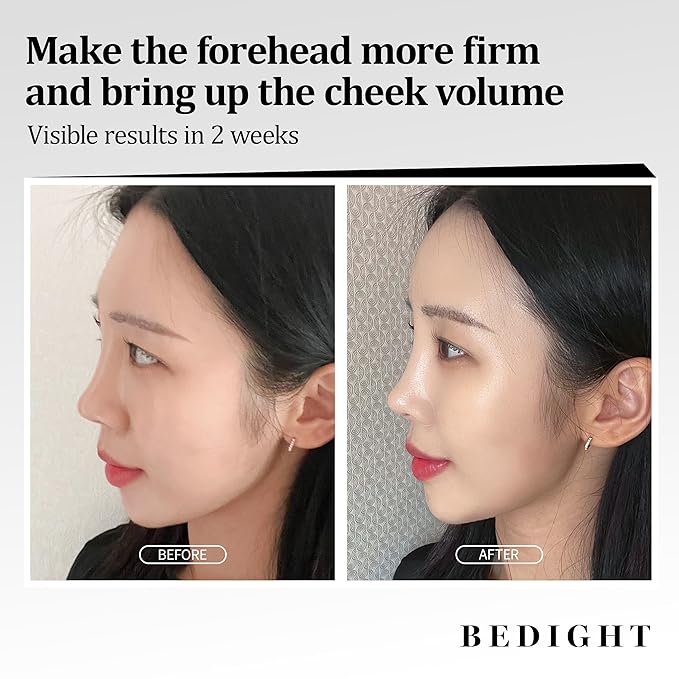 Facemoon Cream - Firming & Volumizing Cream for Forehead & Cheeks | Anti-Aging Wrinkle Cream | Volufiline Korean Wrinkle Peptide for Anti-Sagging | Korean Pocket Ball(50ml / 1.7 fl.oz)