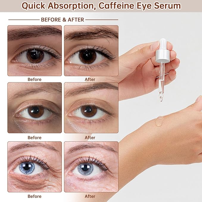The Caffeine Solution 5% + EGCG，Reduces Appearance of Eye Contour Pigmentation and Puffiness，Under Eye Serum (30ml) Caffeine For Face Moisturizing Serum (1)