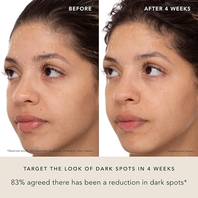 RANAVAT Brightening Saffron Face Serum & Facial Essence - Discoloration Correcting Serum & Hydrating Milk Toner for Dark Spots and Hyperpigmentation - Vitamin C Alternative for a Healthy Glow (2 Pc)