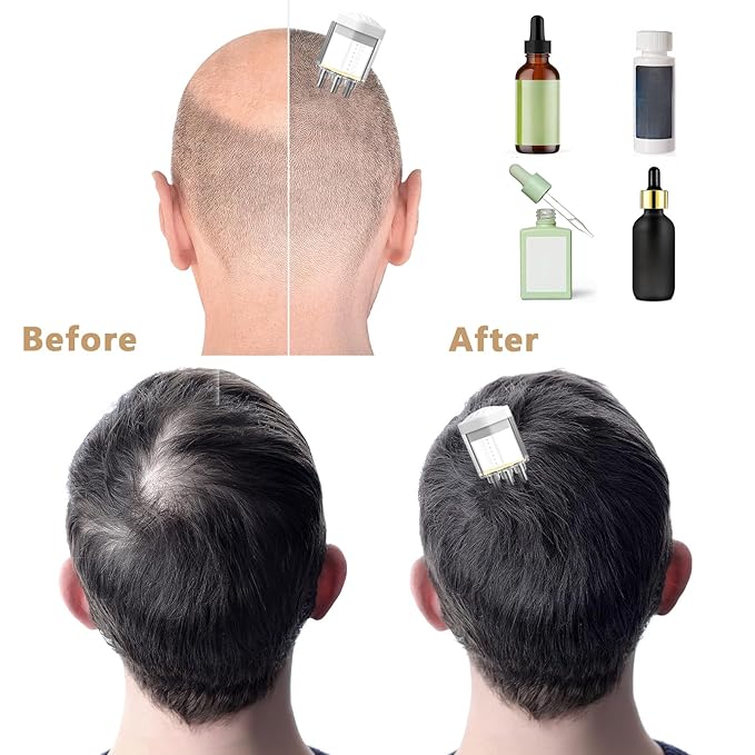 Scalp Applicator Brush Tool Dedicated to Minoxidil, Hair Serum Applicator, Oil Scalp Massage Applicator Comb with Smooth Glide and Even Dispensing(Not lnclude Any Liquids)