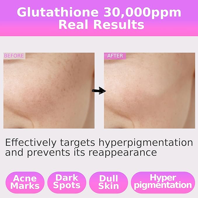 Pure Glutathione Concentrate Mix-in Serum 30,000 ppm w/Niacinamide & Hyaluronic Acid Ceramide | Evens Skin Tone Reduces Hyperpigmentation Acne Scars Dark Spots for Sensitive Skin Korean Skincare