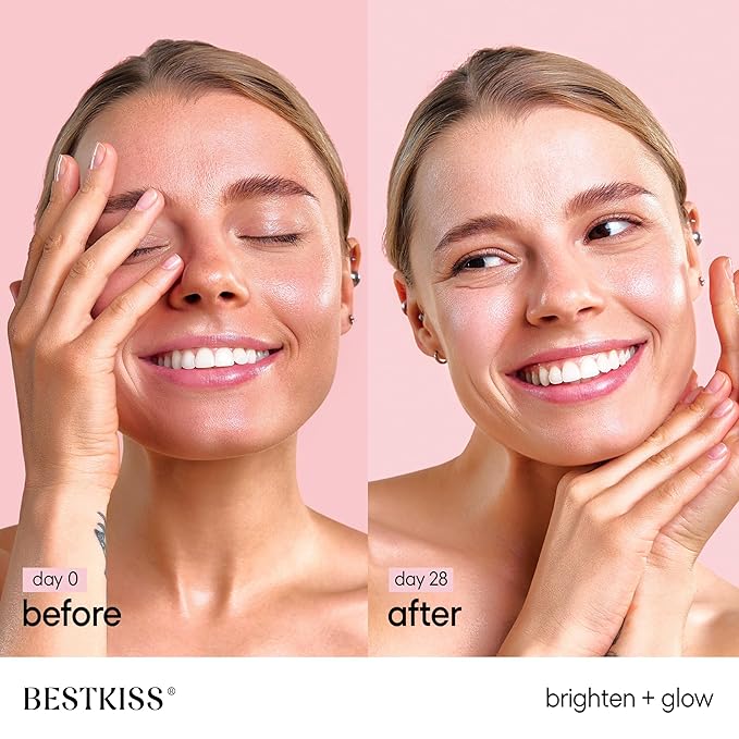 Dark Spot Remover for Face: 3% Watermelon 3% Niacinamide 5% Witch Hazel Dark Spot Correcting Glow Serum with Aloe Vera Centella Asiatica Hyaluronic Acid - Paraben Fragrance Cruelty Free 30mL