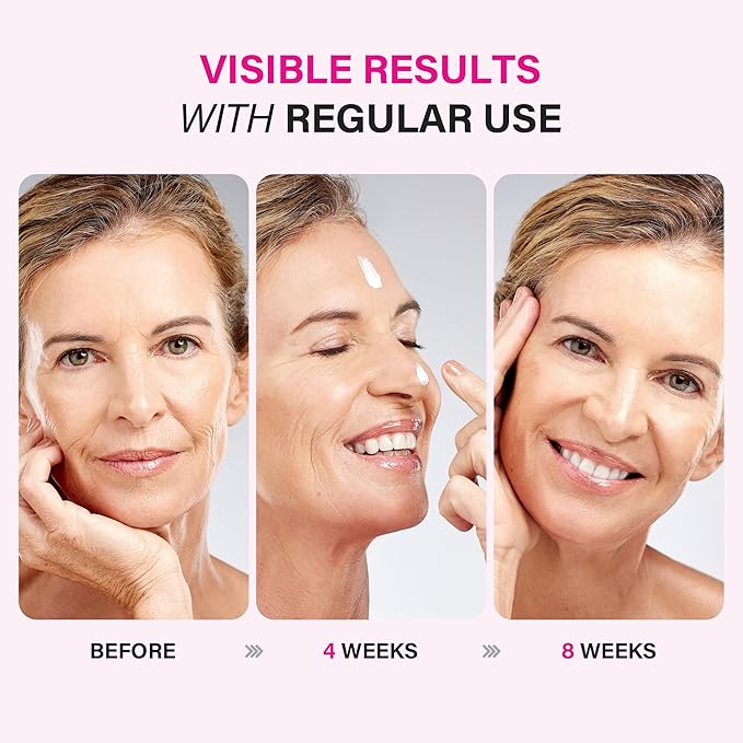 Face Moisturizer for Women Anti Aging: Wrinkle Cream with Retinol Collagen and Hyaluronic Acid for Mature and Aging Skin – Facial Moisturizer for Older Women Over 50 and 60 1.7 fl. oz.