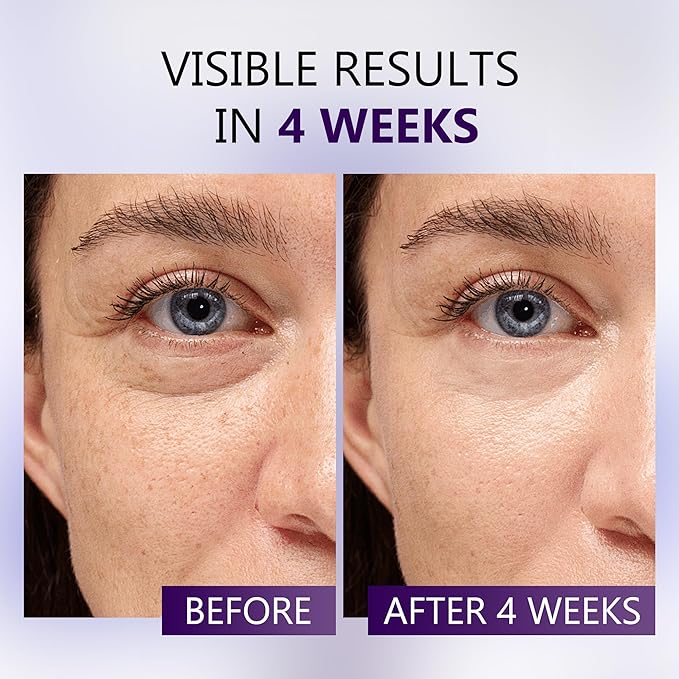 Eye Serum for Dark Circles and Puffiness, Caffeine Eye Serum Infused Collagen and Niacinamide with Ice Globe for Puffy Eyes Treatment for Women (0.5 FL OZ, Unscented)