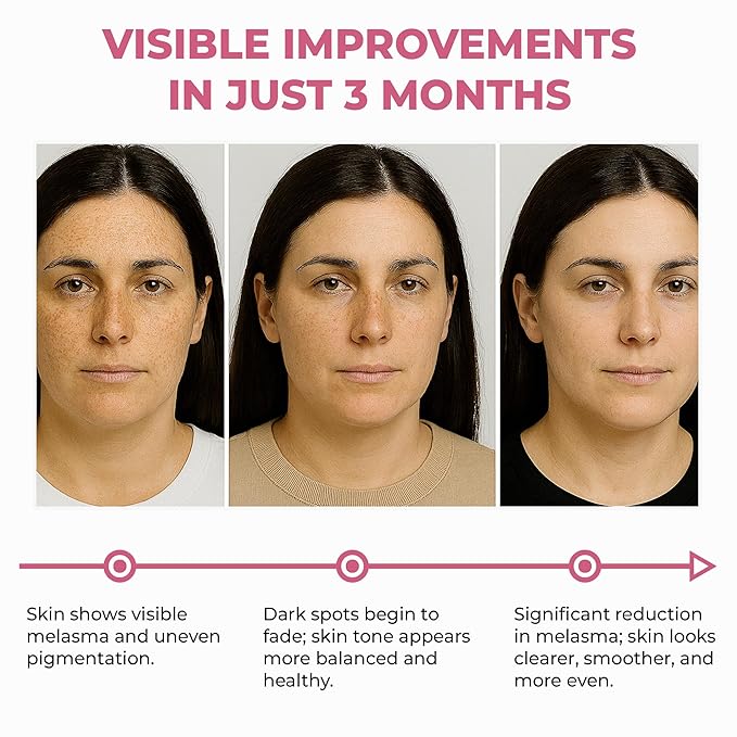 ABERA Skin Renewing Serum For Melasma Treatment, High-Potency Saffron Extract + Gift Curcumin Face Cleanser with Turmeric, Face Wash to Reduce Sebum (3 Boxes + Gift)