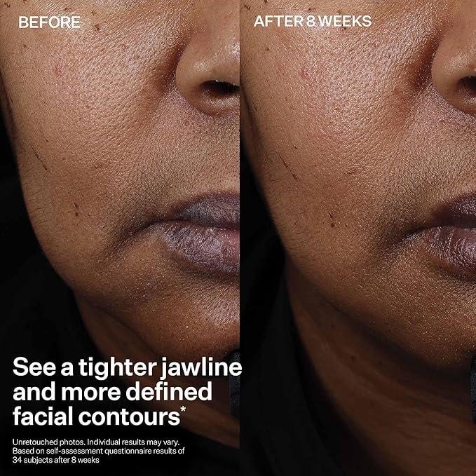 StriVectin Tighten and Lift Peptight Face Lift Serum with Tightening and Brightening Peptides for Wrinkles, Under Eye Bags and Puffiness, 30 mL