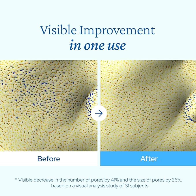 belif Aqua Bomb Cooling Relief Cream with Panthenol & Niacinamide – Daily Soothing & Hydrating Moisturizer, Depuff with Caffeine, Non-comedogenic, Lightweight Cream, Korean Skincare, 1.69 fl oz (50ml)