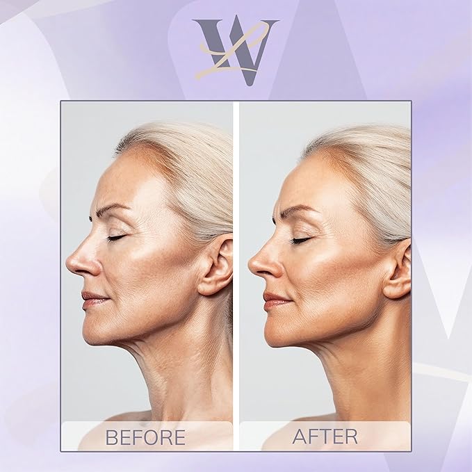 Reusable Neck Wrinkle Patches 2Pcs, Anti Wrinkle Patches, Face Tape for Wrinkles Overnight, Silicone Neck Patches, Silicone Wrinkle Patches for Neck Overnight, Silicone Patches for Wrinkles