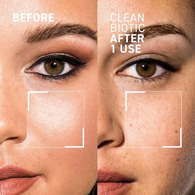 Dr. Brandt Clean Biotic - pH-Balancing Yogurt Cleanser - Melts Away Dirt, Debris, Pollution, Makeup, Sunscreen & Excess Oil - 3.5 fl oz