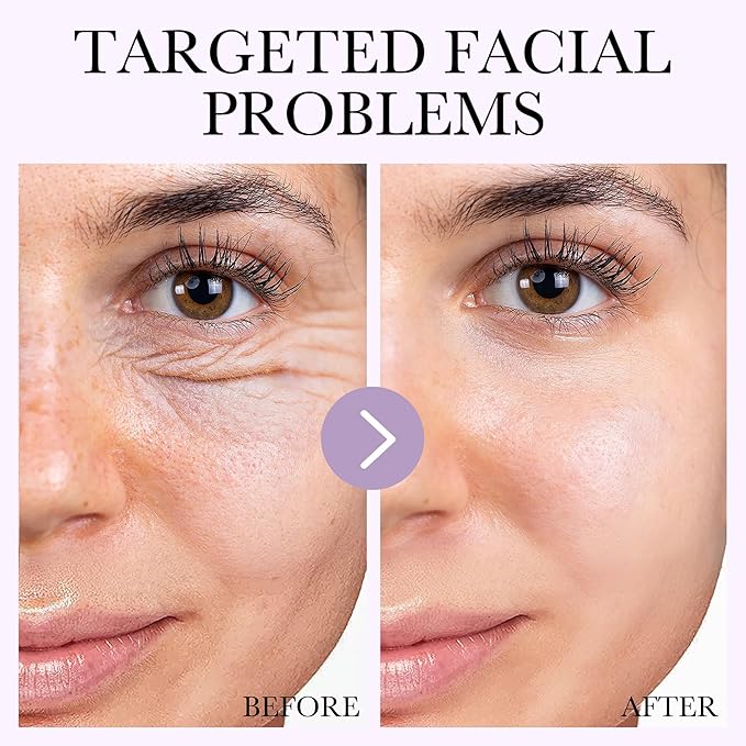 30pcs Under Eye Patches for Puffy Eyes and Dark Circles+6PCS Collagen Face Mask Overnight Bio-Collagen Real Deep Mask+Lip Mask & Lip Scrubber Exfoliator Lip Sleeping Mask Overnight