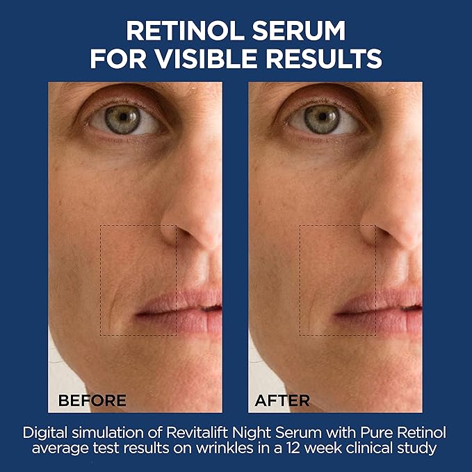 L'Oreal Paris Revitalift 1.5% Pure Hyaluronic Acid Face Serum + 0.3% Pure Retinol Night Serum, 1 kit