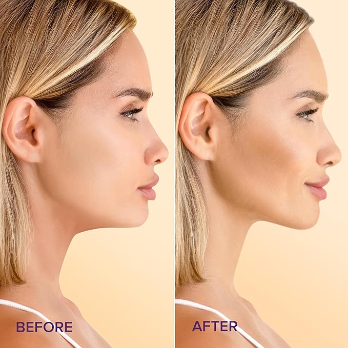 MAREE V Line Lifting Mask with 24K Gold - Deep Collagen Jawline Shaper with Retinol for Face Lift - Facial Skincare Chin Strap - Hyaluronic Acid, Vitamin E | V Lifting Face Mask