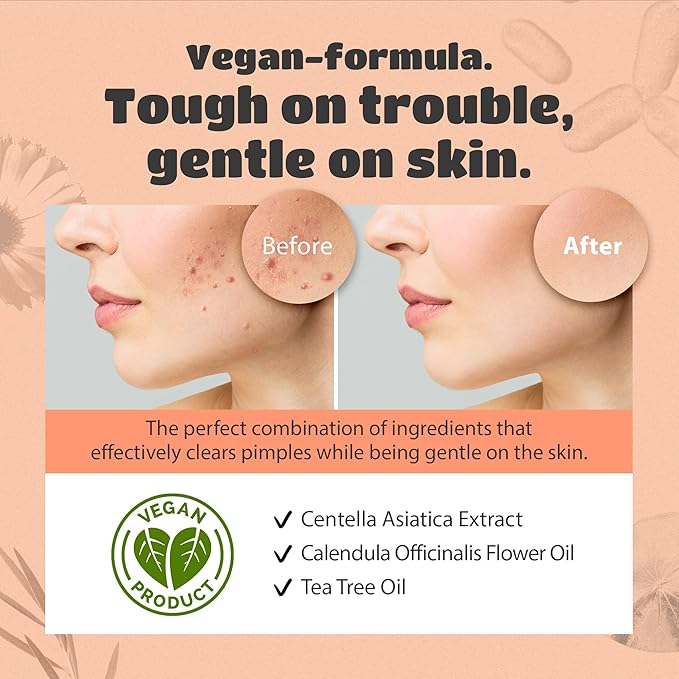 lattcare Pimple Care Patches | Hydrocolloid Acne Patches | Acne Spot Treatment for Blemishes and Zit | Vegan, Cruelty Free Patches | Two Sizes 12mm & 9mm (64 Count)