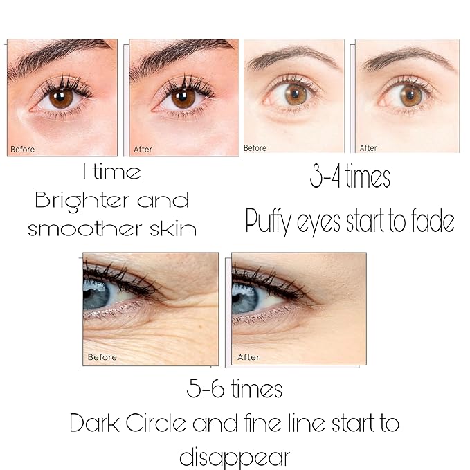 Under Eye Bags Treatment, Rose Eye Mask, Eye Treatment Mask, For Moisturizing,Revitalizing, Lift & Firm, Anti- Dark Circle, Depuffing. Cruety-Free. (60 Pieces)